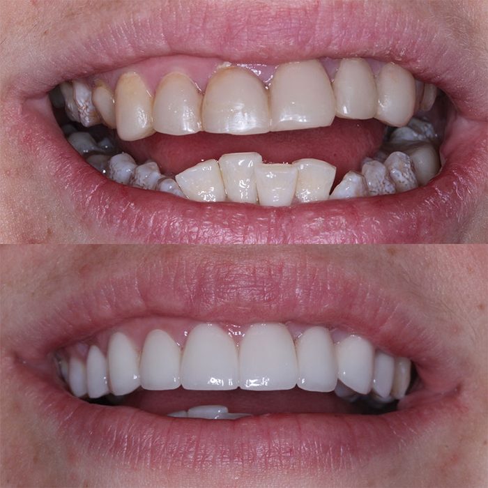 Before and after dental treatment result