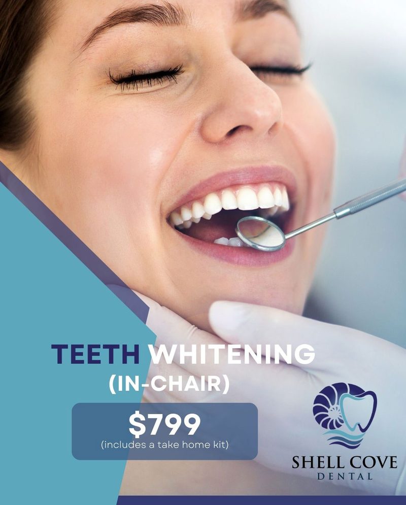 Teeth whitening offer at Shell Cove Dental